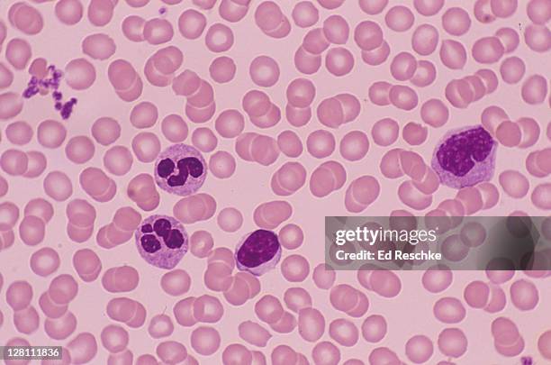 human blood smear; red blood cells, platelets and white blood cells, 250x - platelet stock-fotos und bilder