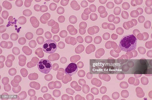 human blood smear; red blood cells, platelets and white blood cells, 250x - neutrophil stock pictures, royalty-free photos & images