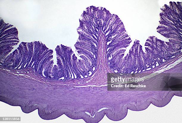 light micrograph of large intestine of human. mucosa, submucosa, muscularis, serosa, 10x at 35mm. goblet cells are visible in the mucosa. - membrane fotografías e imágenes de stock