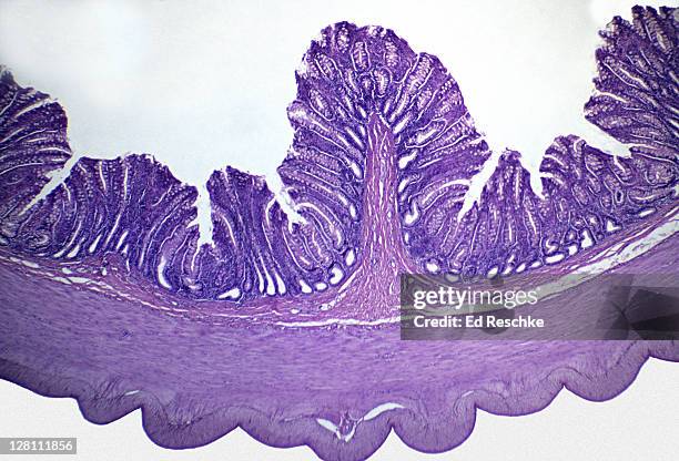 light micrograph of large intestine of human. mucosa, submucosa, muscularis, serosa, 10x at 35mm. goblet cells are visible in the mucosa. - microphotographie immunofluorescente photos et images de collection