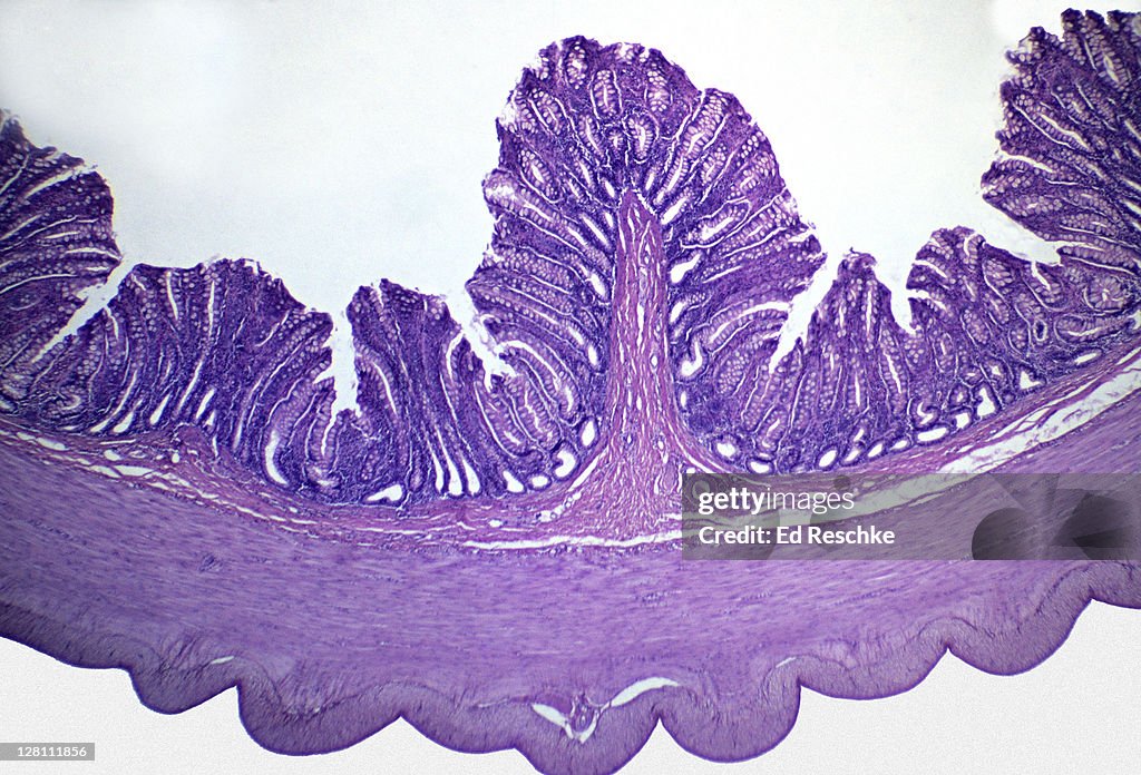 Light micrograph of large intestine of human. Mucosa, Submucosa, Muscularis, Serosa, 10x at 35mm. Goblet cells are visible in the mucosa.