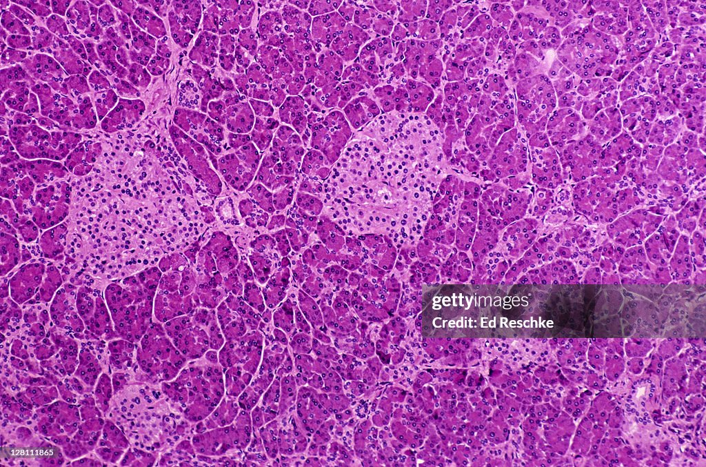 Light micrograph of human pancreas. Islands of Langerhans, Acinar Cells, and Ducts, 25x at 35mm. Shows endocrine tissue (ductless), and exocrine tissue (acinar cells with ducts).