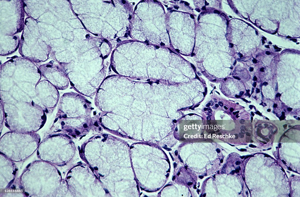 Light micrograph of human sublingual salivary gland; mucous cells and a duct, 100x at 35mm. This is a mixed gland, but is mostly made up of mucous alveoli.