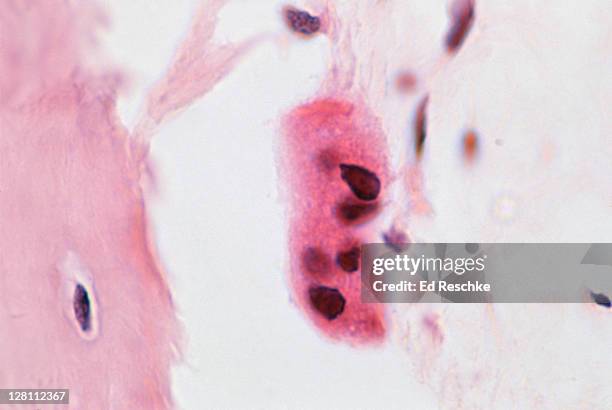 osteoclast. large, multinucleated cell,400x - osteocyte stock pictures, royalty-free photos & images