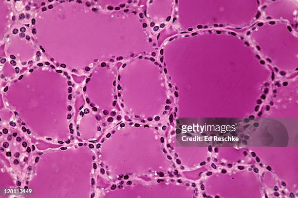 thyroid gland. 100x at 35mm. shows: follicles, colloid, and simple cuboidal epithelium. human. - tejido epitelial fotografías e imágenes de stock