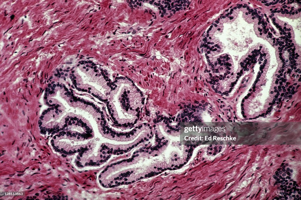Prostrate Violet Portion Of Human Prostate Gland Young Prostate Is Tubuloalveolar Gland ...