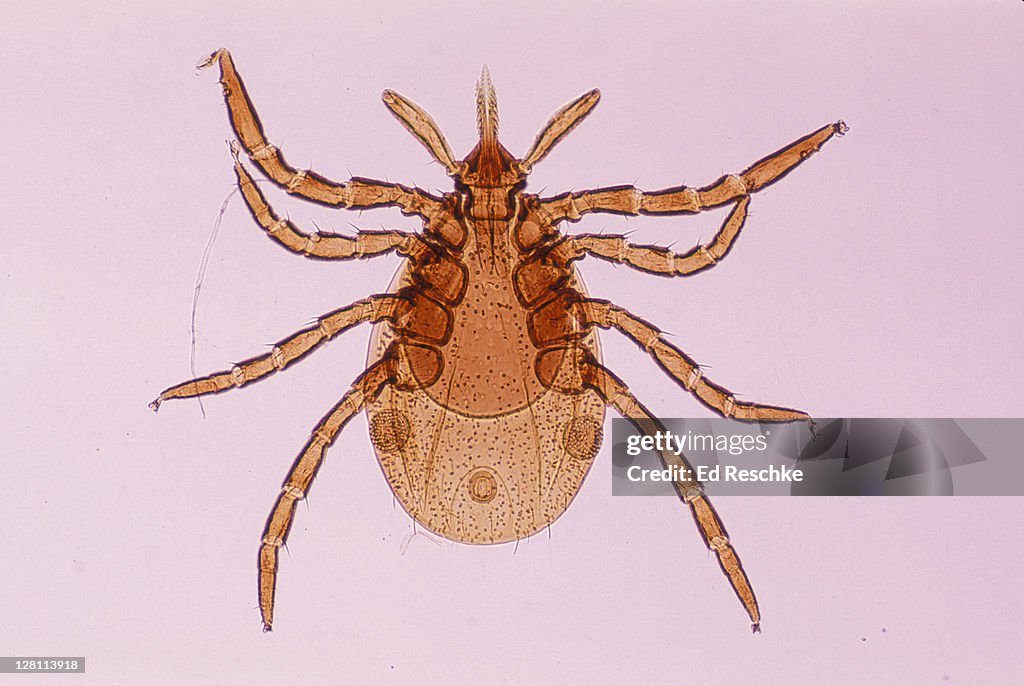 DEER TICK NYMPH. IXODES DAMMINI. VECTOR OF LYME DISEASE. HEAD CONTAINS FORMIDABLE PIERCING ORGAN (HYPOSTOME). 10X