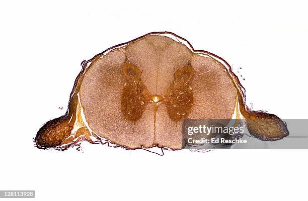 spinal cord cross section. shows gray & white matter, central canal, motor neuron, dorsal and ventral roots. 3x - spinal neuron imagens e fotografias de stock