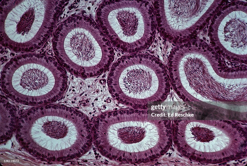 EPIDIDYMIS. SHOWS SPERM IN LUMENS, STEREOCILIA, EPITHELIUM, CONNECTIVE TISSUE (BETWEEN TUBULES) 50X