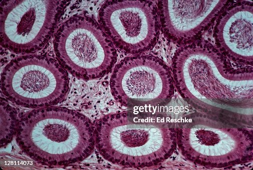 EPIDIDYMIS. SHOWS SPERM IN LUMENS, STEREOCILIA, EPITHELIUM, CONNECTIVE TISSUE (BETWEEN TUBULES) 50X EPIDIDYMIS. SHOWS SPERM IN LUMENS, STEREOCILIA, EPITHELIUM, CONNECTIVE TISSUE (BETWEEN TUBULES) 50X