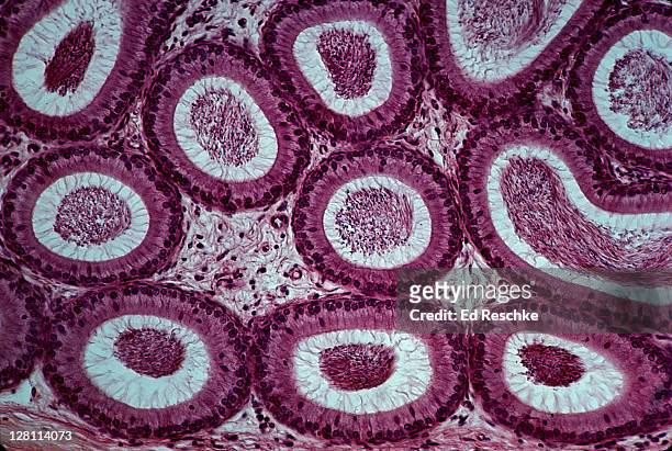 epididymis. shows sperm in lumens, stereocilia, epithelium, connective tissue (between tubules) 50x - célula humana - fotografias e filmes do acervo