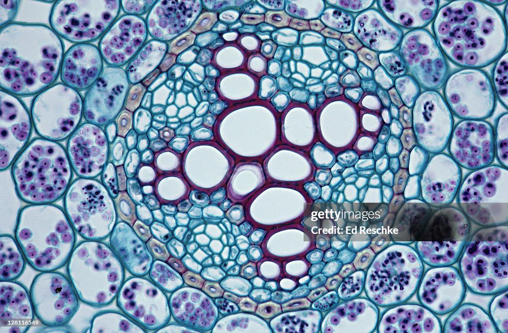 Ranunculus (buttercup) root. Stele cross section. Shows: Endodermis (yellow), xylem, starch grains. Dicot. 100X at 35mm