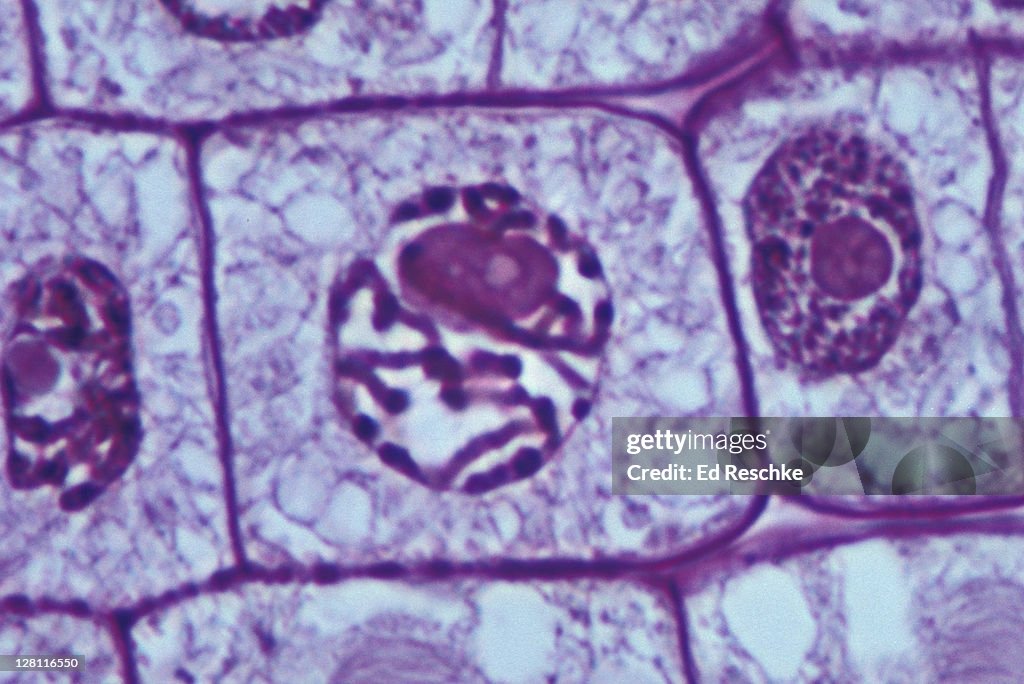 Prophase Mitosis Onion Root Tip Chromosomes Nuclear Membrane Nucleus Visible 640x At 35mm High ...