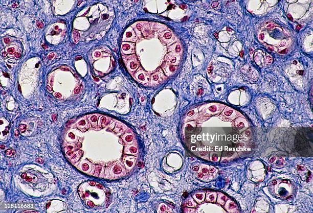 simple cuboidal epithelium. kidney tubules (collecting ducts) cross sections, 100x at 35mm. shows: cuboidal epithelium, collecting ducts in cross section, lumens, supporting connective tissue - microfotografia immunofluorescente foto e immagini stock