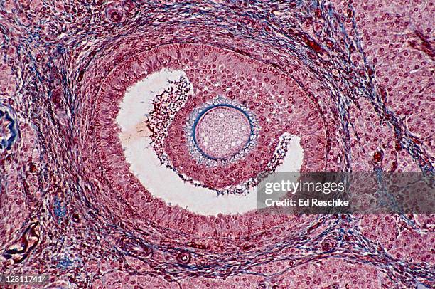 ovarian follicle. shows egg (oocyte), follicular cell (secrete hormones), follicular fluid. 50x at 35mm - human egg cell stock pictures, royalty-free photos & images