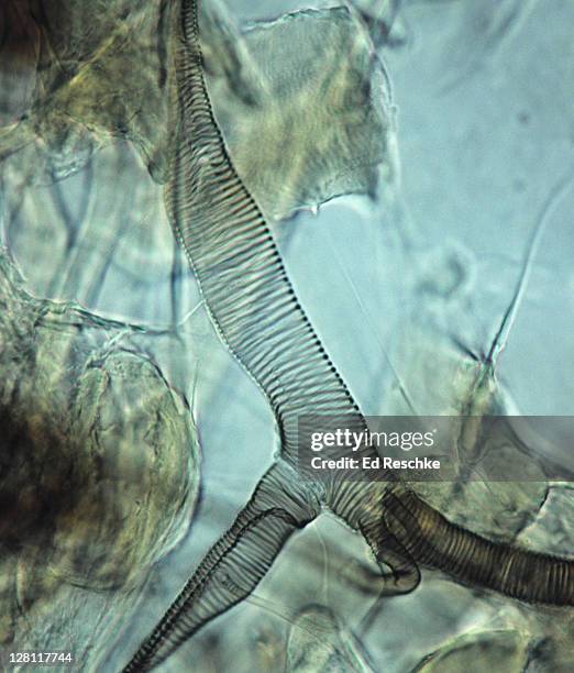 insect tracheal system. pediculus humanus capitis. head louse, 100x. shows the fine, branching tracheal tubes with reinforcing rings. this system delivers oxygen to the cells of the body. - pediculosis capitis stock pictures, royalty-free photos & images