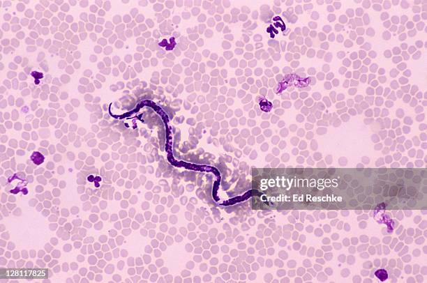 dog heart worm. dirofilaria immitis. microfilariae. blood smear, 100x at 35mm - parasitisk bildbanksfoton och bilder