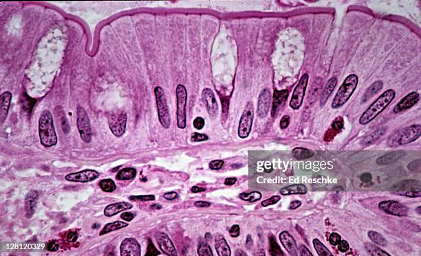 simple columnar epithelium. small intestine (ileum, human) 250x at 35mm. shows: simple columnar absorptive cells, goblet cells (mucus-secreting, clear), striated border (made up of microvilli seen with the electron microscope) & supporting connective tissu - small intestine stock pictures, royalty-free photos & images