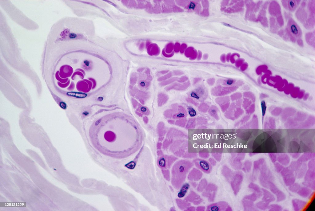 BLOOD VESSELS SHOWS BLOOD CELLS AND ENDOTHELIUM 1000X V