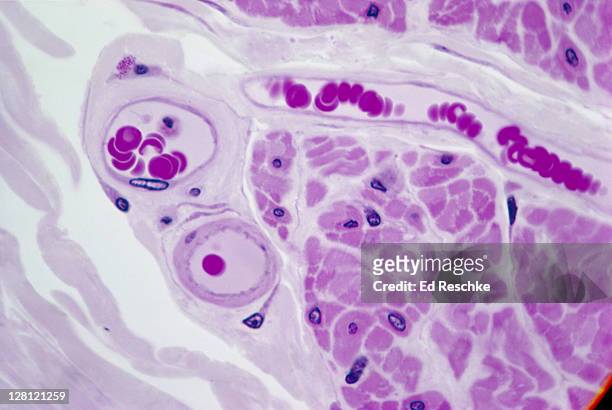 blood vessels shows blood cells and endothelium 1000x v - endothelial stock pictures, royalty-free photos & images