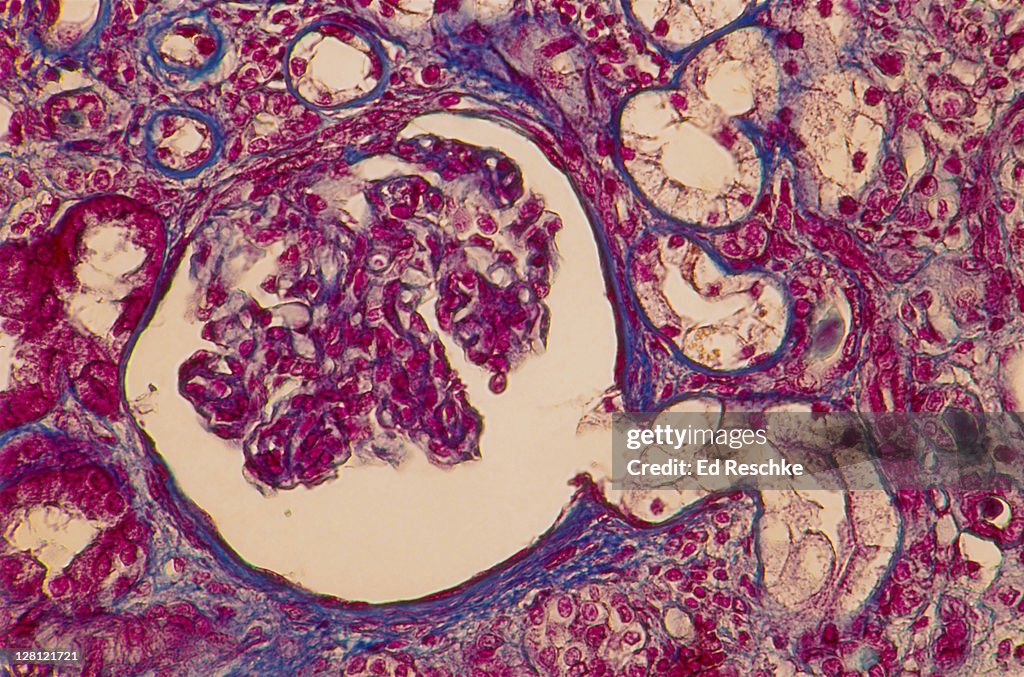 HUMAN KIDNEY. GLOMERULUS, BOWMAN''''S CAPSULE, PROXIMAL CONVOLUTED TUBULE. 100X