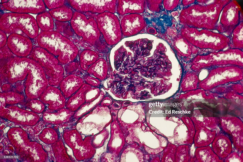 HUMAN KIDNEY.RENAL CORPUSCLES AND GLOMERULI,BOWMAN''''S CAPSULES, RENAL TUBULES,MALLORY STAIN. 50X