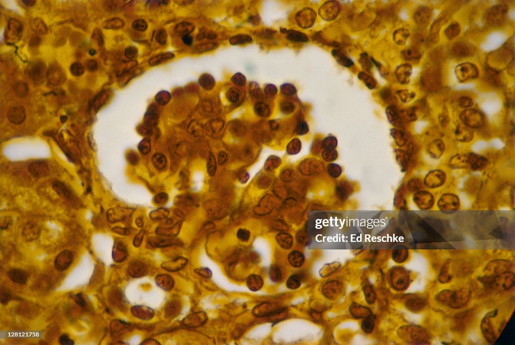 KIDNEY. GLOMERULUS & BOWMAN''''S CAPSULE. H