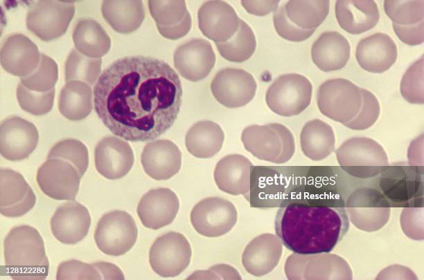 red blood cells & platelet of human blood smear. (neutrophil on top. lymphocyte at bottom.) - sangue umano foto e immagini stock