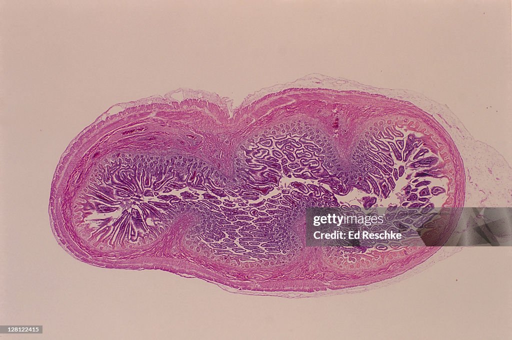 SMALL INTESTINE HUMAN.FETAL,CROSS SECTION.VILLI, MUCOSA, SUBMUCOSA 2.5X CIRCULAR/LONGT. MUSCLE LAYERS,SEROSA LONG-LONGITUDINAL