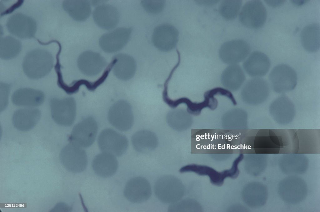 TRYPANOSOMES.BLOOD SMEAR.CAUSE SLEEPING SICKNESS. 1000X H