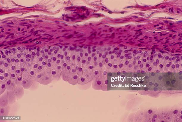 ureter-transitional epithelium (si) unstretched state, also in bladder many cell layers near surface,100x h sim to 154190 - transitional epithelium stock pictures, royalty-free photos & images