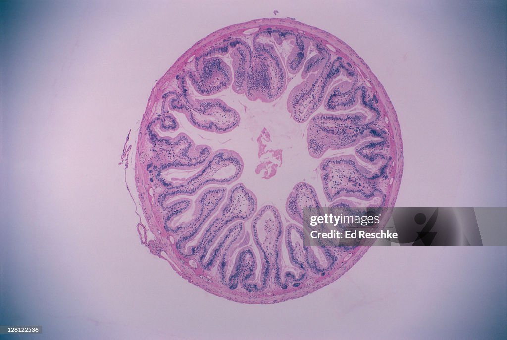 VILLI,SMALL INTESTINE.C.S.5X VILLI,MUCOSA,SUBMUCOSA,MUSCULARI S, SMOOTH MUSCLE,SEROSA V