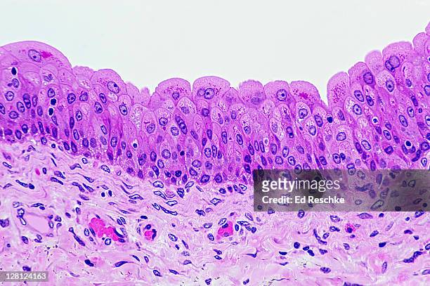 transitional epithelium of human bladder (magnification x100). h & e stain. cells near the surface are the pear-shaped basement membrane, with supporting connective tissue below - epithelium stock pictures, royalty-free photos & images