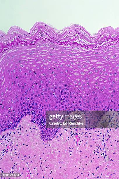 stratified squamous epithelium of human vagina (magnification x 50) h & e stain. non-keratinized. cells become very flat near surface. - epitelio imagens e fotografias de stock