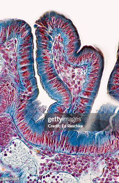 simple columnar epithelium and villi of small intestine-(magnification x100): simple columnar epithelium, villi, mucosa, lamina propria, muscularis mucosae and striated border. - simple columnar epithelial cell stock pictures, royalty-free photos & images