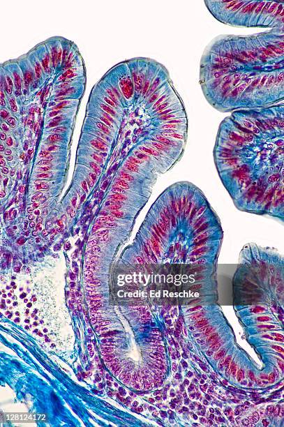 simple columnar epithelium and villi of small intestine (magnification x100): simple columnar epithelium, villi, mucosa, lamina propria, muscularis mucosae and striated border. - lamina propria stock-fotos und bilder