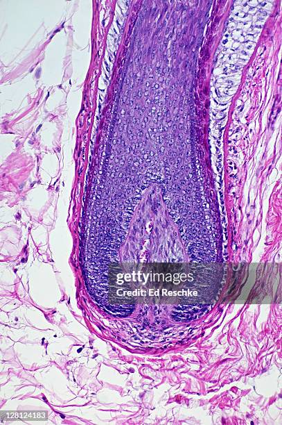 hair papilla, bulb and follicle of human scalp (magnification x50) h & e stain: the base of the hair follicle is where growth takes place. the papilla shows a capillary with red blood cells. - red blood cells photos et images de collection