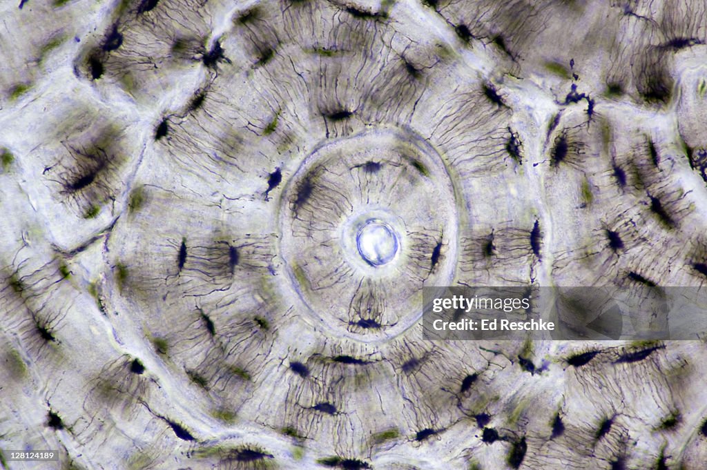 Compact Bone of Human Haversian System (Osteon) with prominent Canaliculi and lacunae. (Magnification x100) Ground bone.