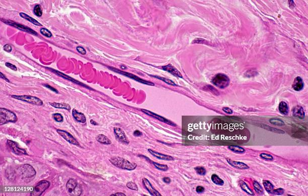 capillary with red blood cells in rouleaux (magnification x250) h & e stain. red blood cells (erythrocytes) can form stacks called rouleaux which can form and dissociate repeatedly, facilitating movement through the small capillaries. also shows capillary - 毛細血管 ストックフォトと画像