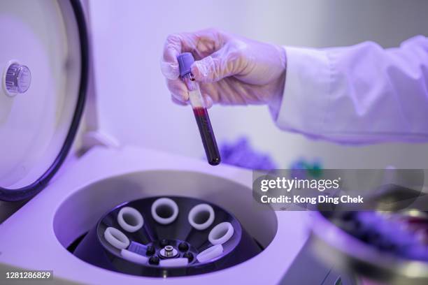la doctora china de asia puso muestras de sangre en viales en una máquina de centrífugas. análisis de sangre covid-19 - plasma rico en plaquetas fotografías e imágenes de stock