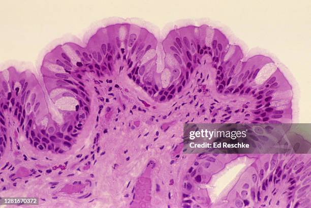 trachea--pseudostratified ciliated columnar epithelium, 100x - mehrreihige epithel stock-fotos und bilder