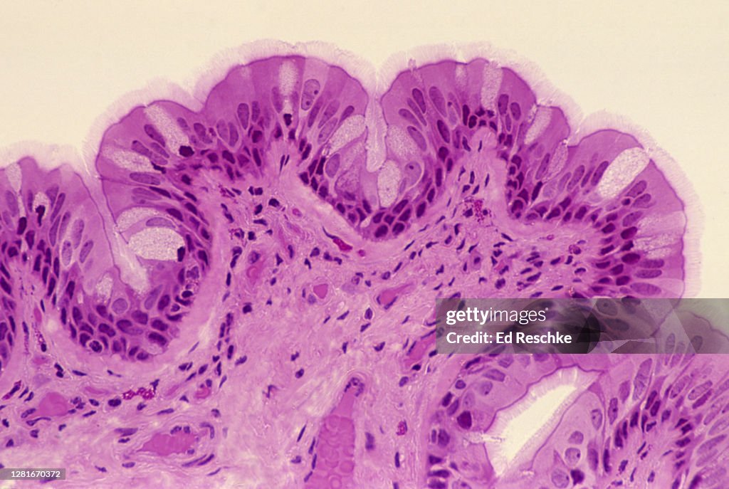 TRACHEA--PSEUDOSTRATIFIED CILIATED COLUMNAR EPITHELIUM, 100X