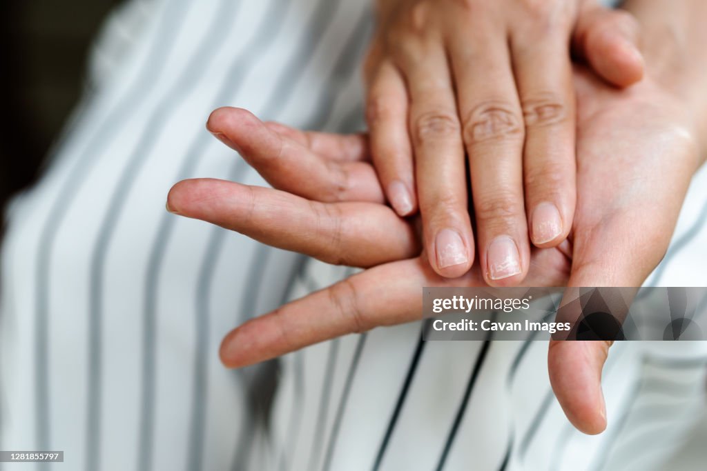 Brittle damaged nails after using shellac or gel-lacquer