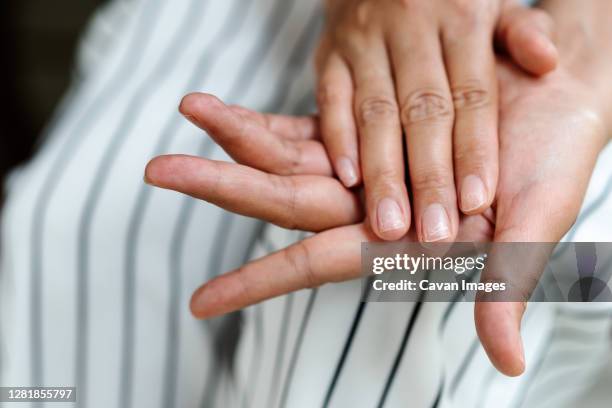 brittle damaged nails after using shellac or gel-lacquer - fingernail imagens e fotografias de stock