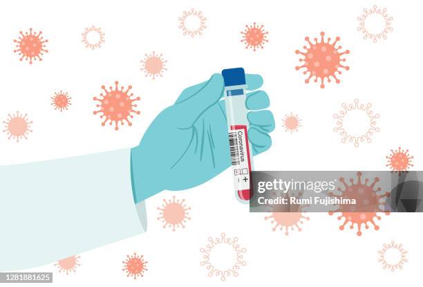 blood sample - taste test stock illustrations