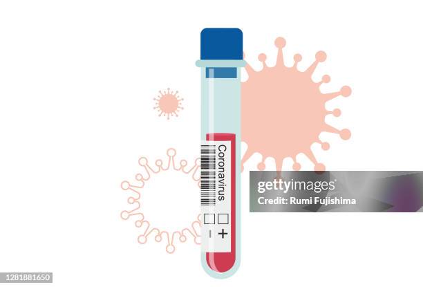 blood sample - taste test stock illustrations