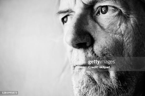 face of senior man with scar and bruises - guy with scar stock pictures, royalty-free photos & images