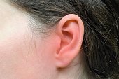 Woman's ear with red marks of inflammation, health problem