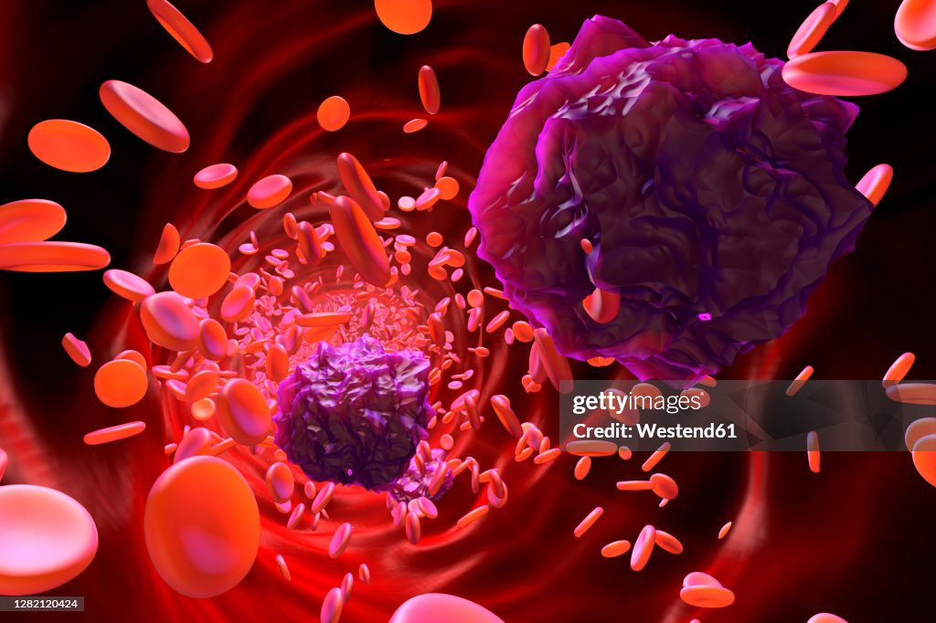 3D rendered Illustration of Leukemia cells in the blood stream