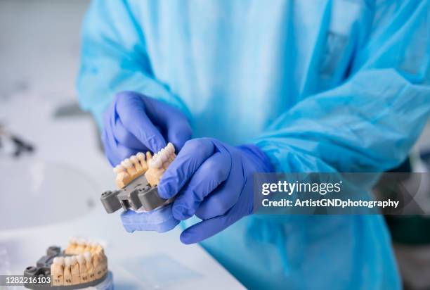 dentista organizando coroas de dentes de zircônio. - implante dentário - fotografias e filmes do acervo